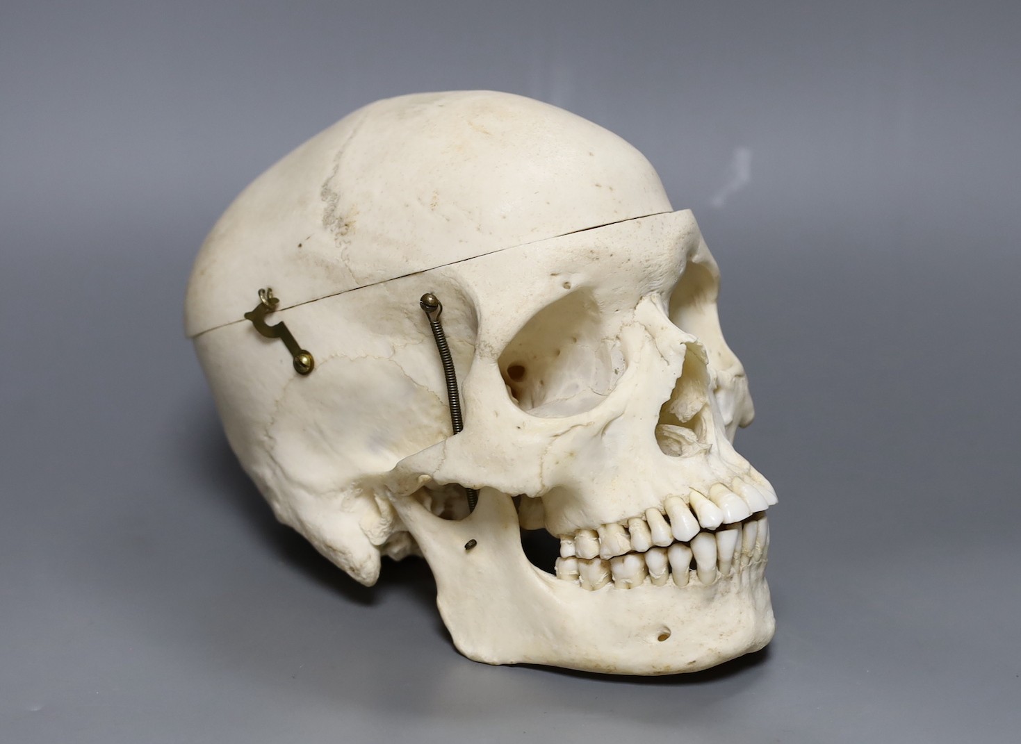 A human skull, 21 cms wide                                                                                                                                                                                                  